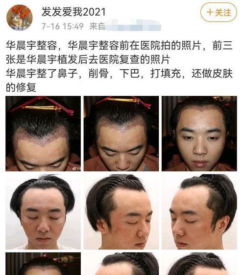 王炸前女友爆料视频,揭秘昔日恋情内幕